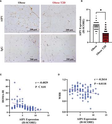 ASK1-Interacting Protein 1 Acts as a Novel Predictor of Type 2 Diabetes